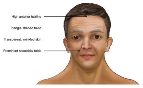 Adult Features .